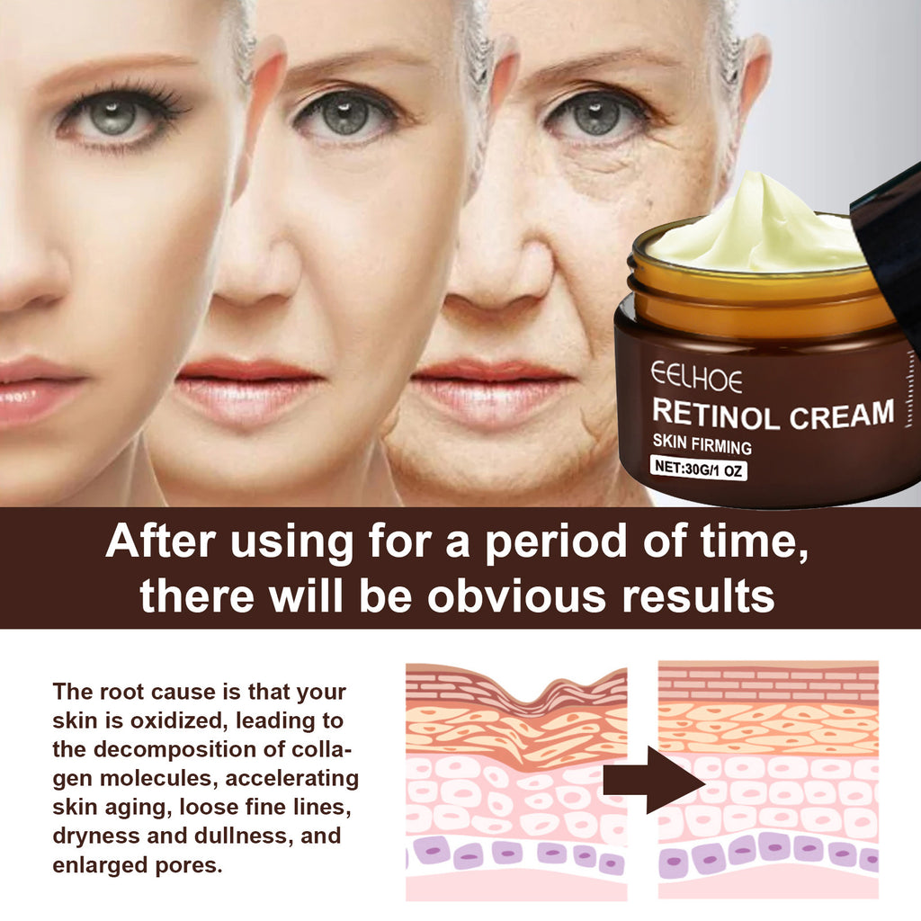 Retinol Anti Aging Cream for Fine Lines Wrinkles Skin Renewal Nightly