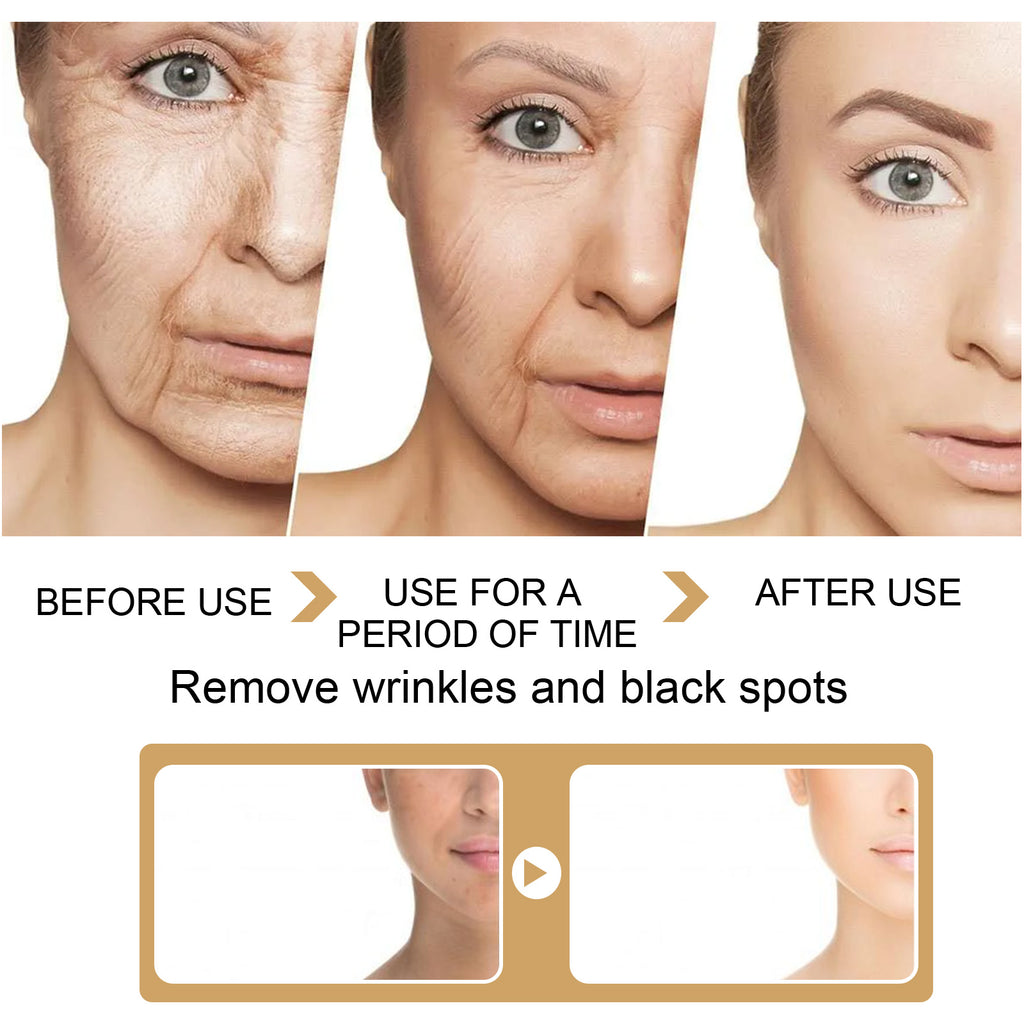 Turmeric Dark Spot Correcting Serum For Uneven Skin Tone
