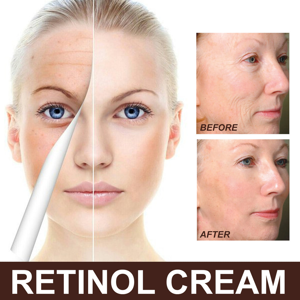 Retinol Anti Aging Cream for Fine Lines Wrinkles Skin Renewal Nightly
