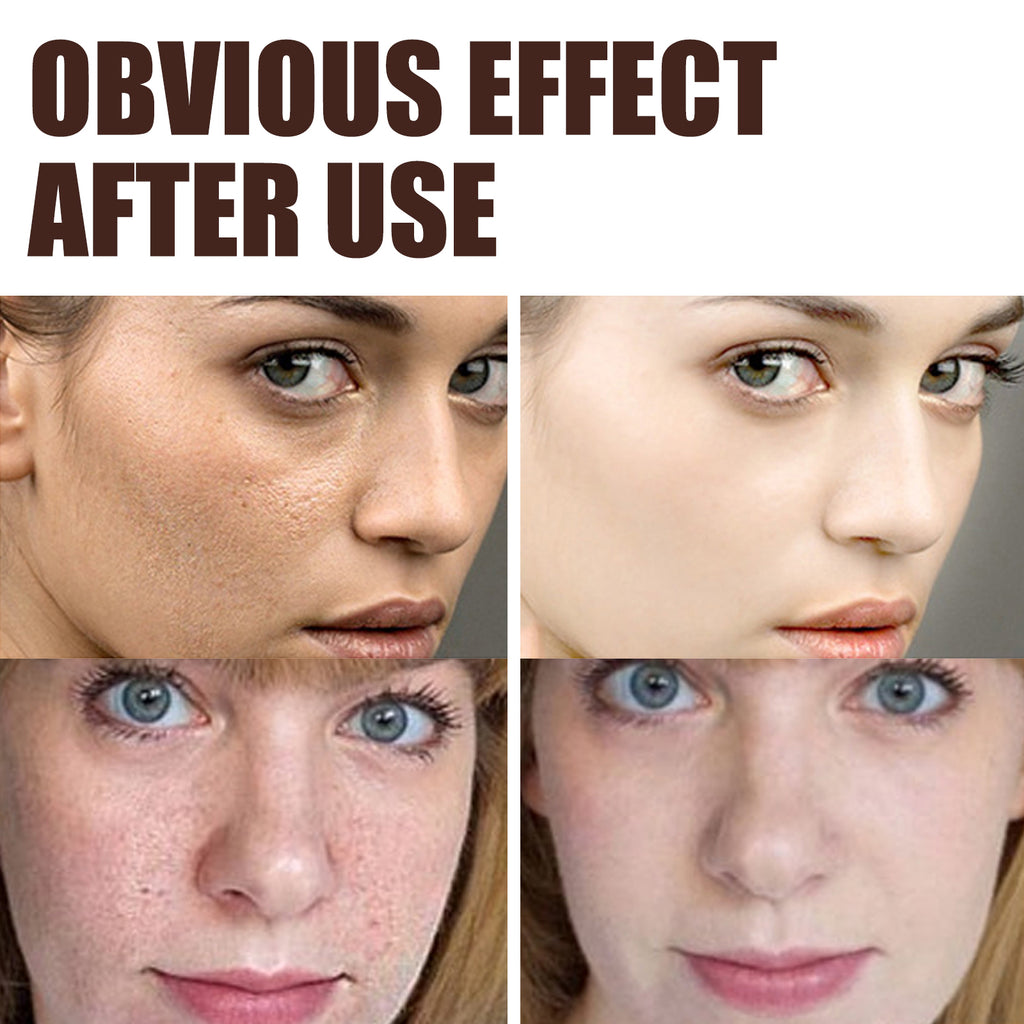 Retinol Anti Aging Cream for Fine Lines Wrinkles Skin Renewal Nightly