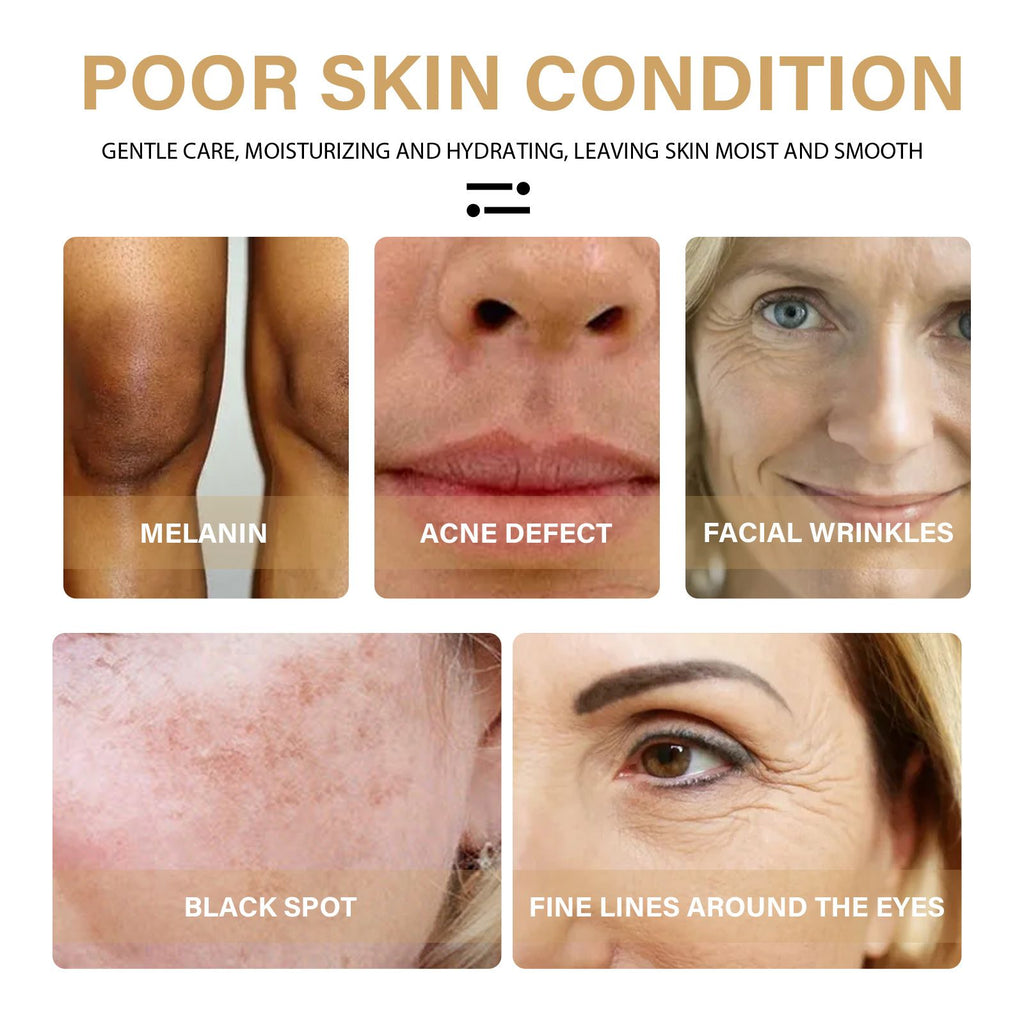 Turmeric Dark Spot Correcting Serum For Uneven Skin Tone
