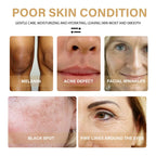 Turmeric Dark Spot Correcting Serum For Uneven Skin Tone